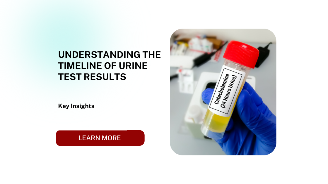 Understanding the Timeline of Urine Test Results