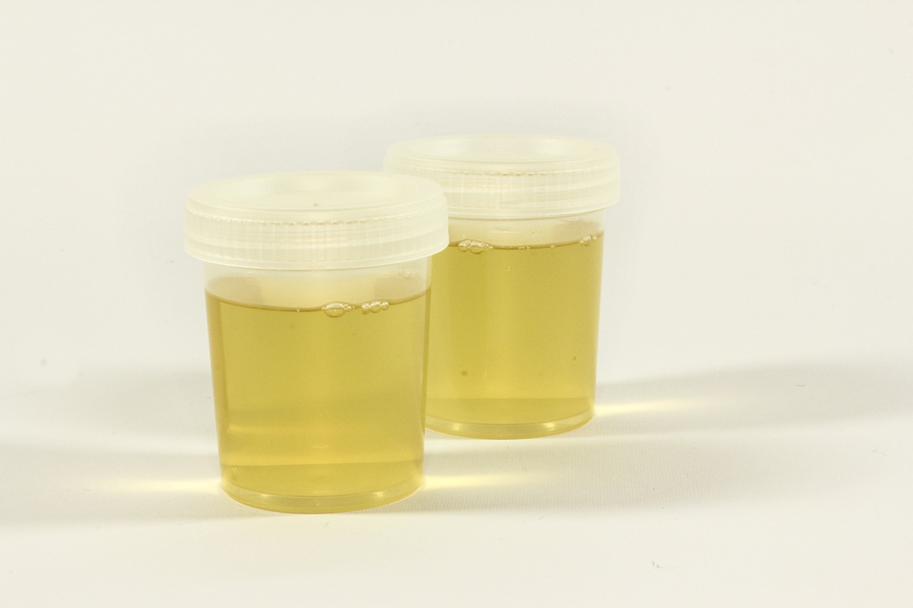 How Much Urine is Typically Required for a Drug Test?